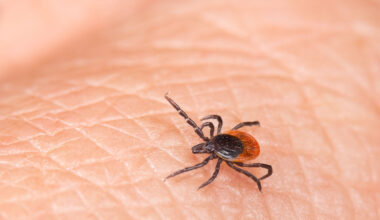 DC-area emergency rooms are seeing more patients with tick bites