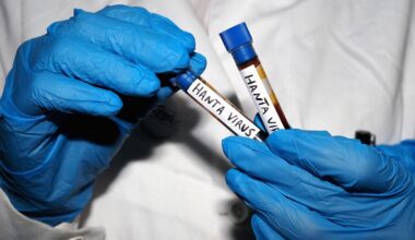 All Your Hantavirus Questions, Answered by an Infectious Disease Expert