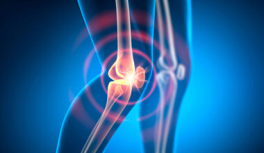 Knee Joint Pain Arthritis