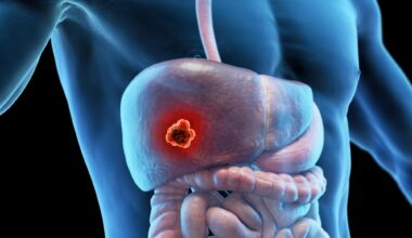 Liver Cancer Male Anatomy