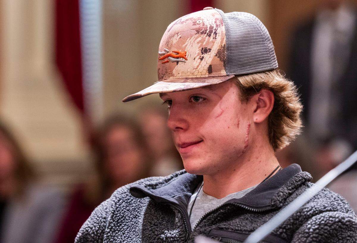 Wyatt Brooks, of El Dorado County, listens to testimony for Senate Bill 818, “Taylen and Wyatt’s Law,” on Tuesday, April 22, 2025 at the state Capitol. Wyatt was injured by a mountain lion that killed his brother last year. SB 818 would allow trained dogs and their handlers to chase away mountain lions.