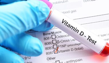 Vitamin D3 fortified chocolate effective for correcting deficiency