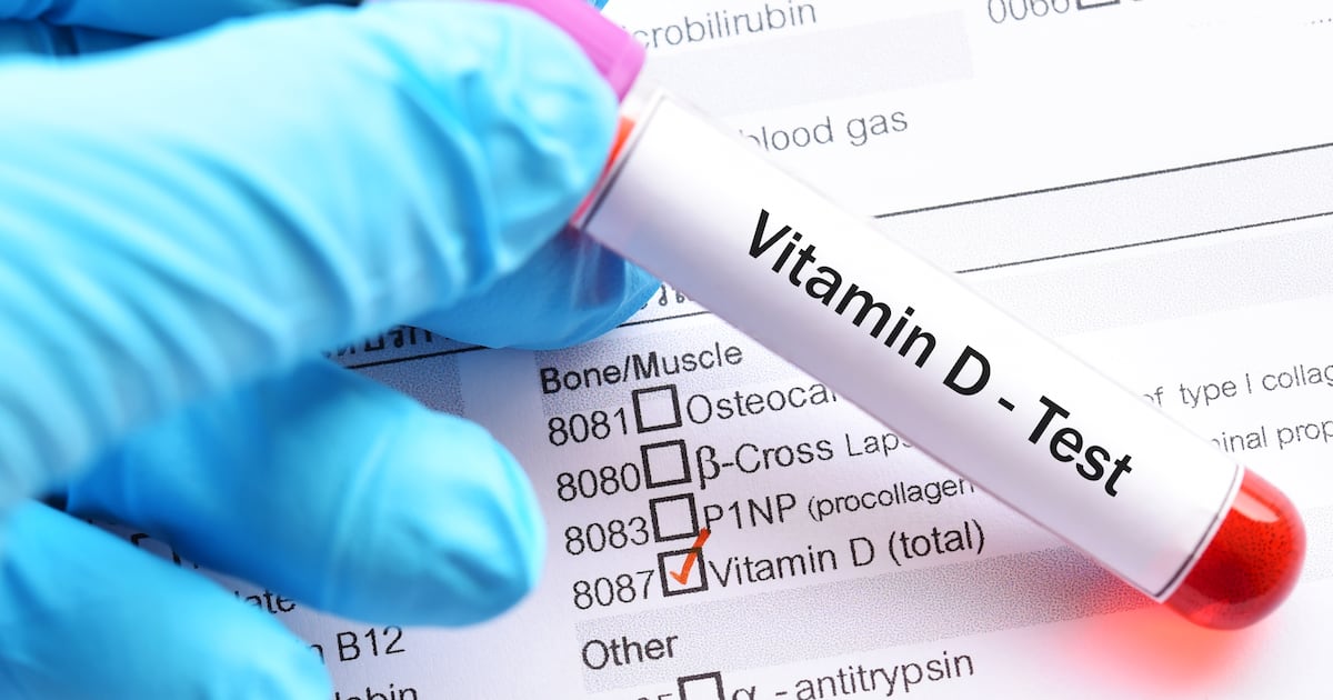 Vitamin D3 fortified chocolate effective for correcting deficiency