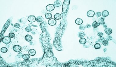 Colorado Reports Its First Hantavirus Death Since 2024