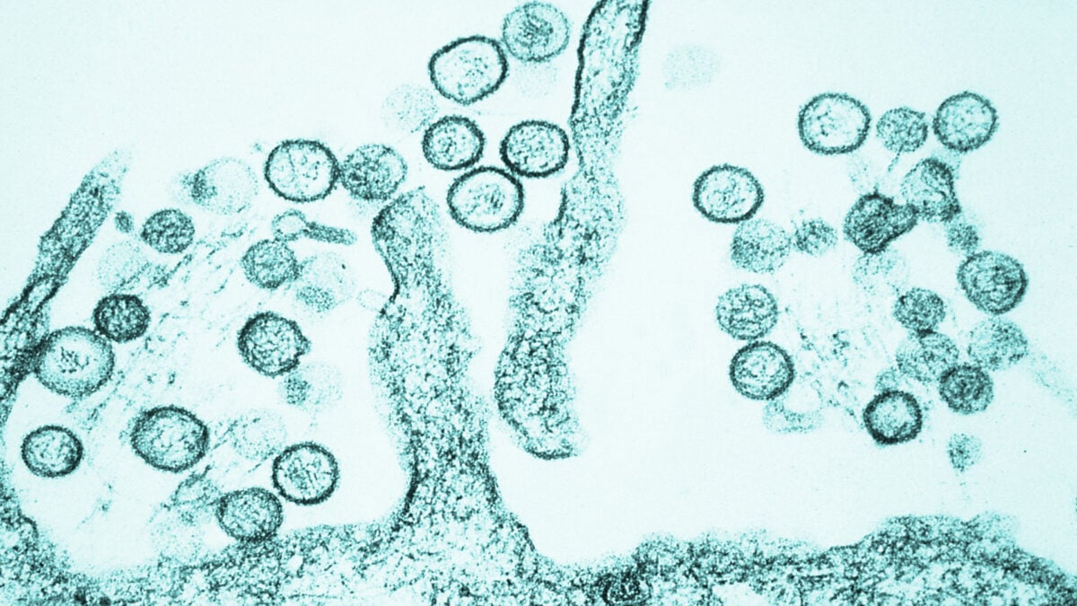 Colorado Reports Its First Hantavirus Death Since 2024