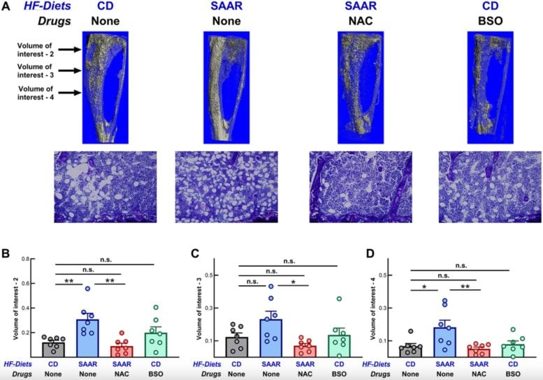The SAAR Diet but Not BSO Increases Marrow Adipocytes in Tibiae