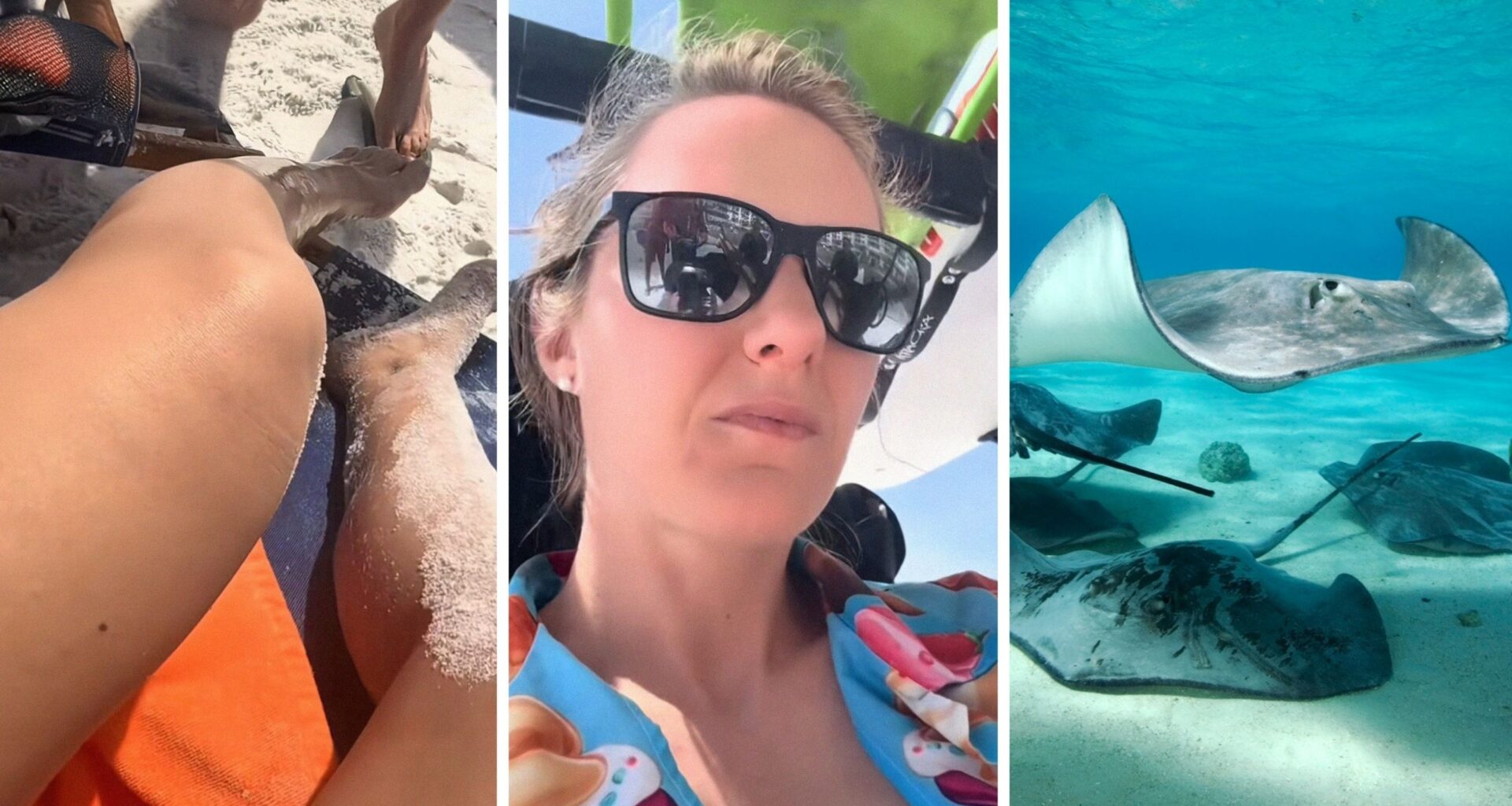 injured feet (l) woman shares stingray warning (c) group of stingrays (r)