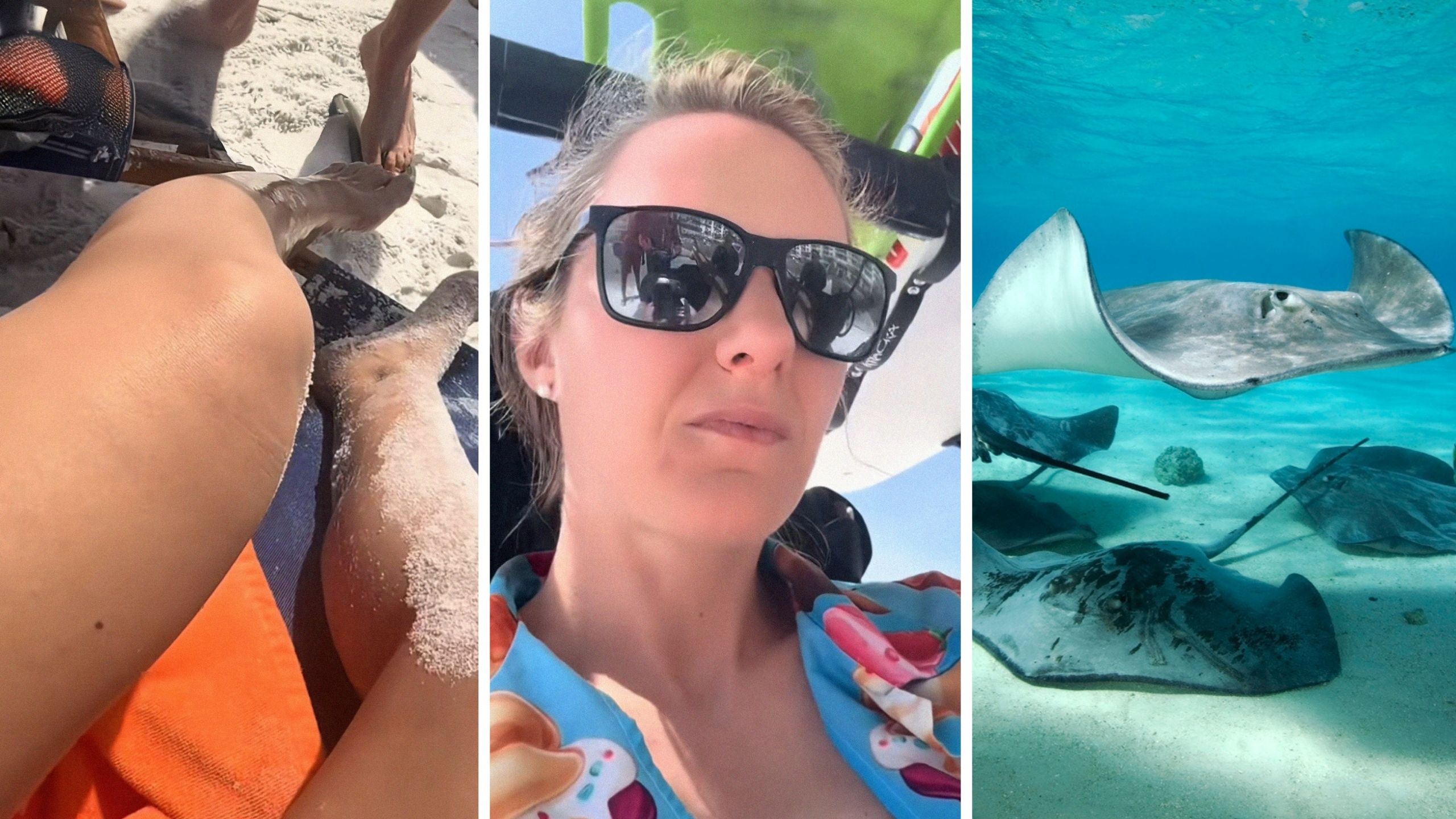 injured feet (l) woman shares stingray warning (c) group of stingrays (r)