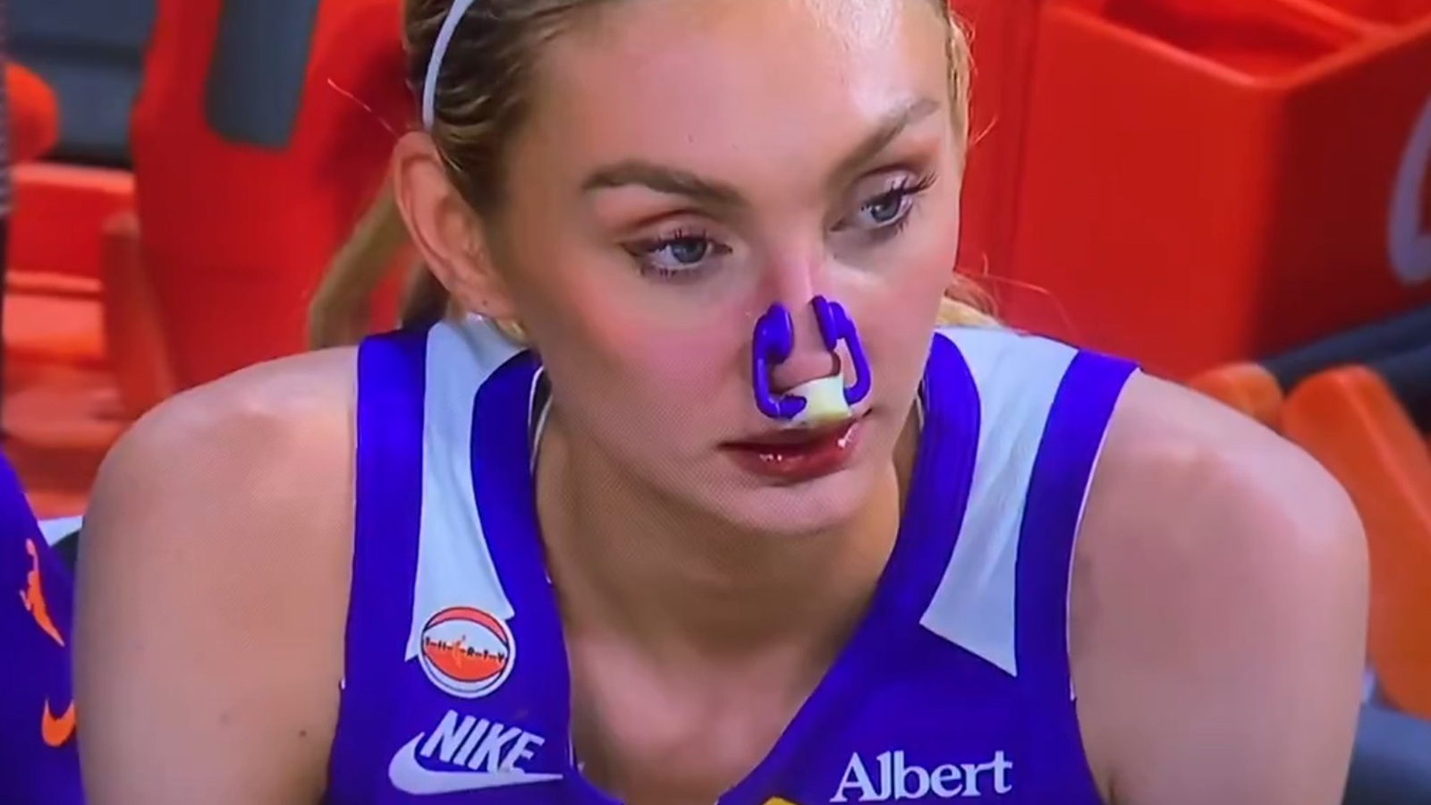 Cameron Brink wearing a nose brace