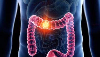 Oncologist who cut open people for 17 years saw same foods in 80% of colon cancer patients