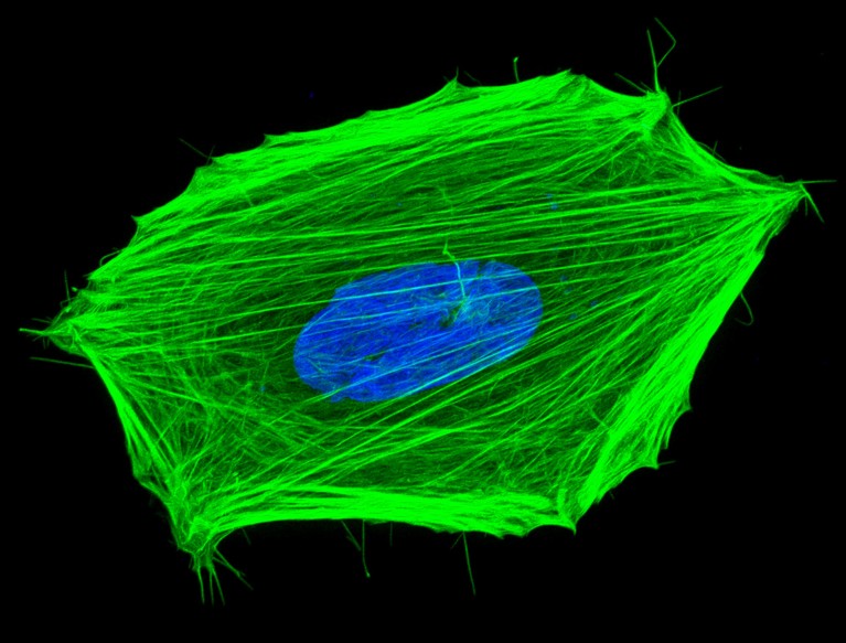 Confocal light micrograph of a cancer cell stained with a fluorescent compound that resembles stringy material around a bean-shaped nuclei.