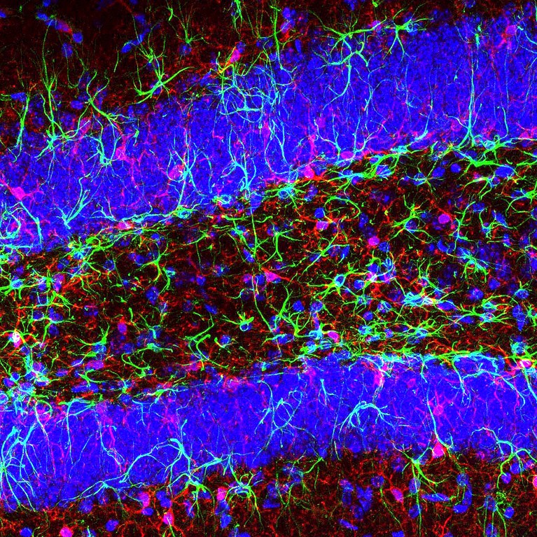Fluorescence light micrograph of a section through tissue from the hippocampus of a human brain showing glial cells and neurons.