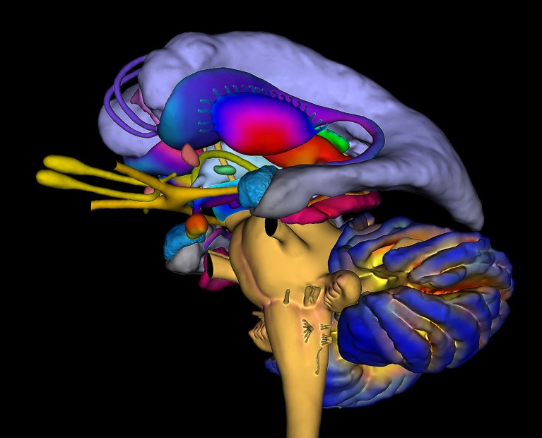 Coloured 3D magnetic resonance imaging (MRI) scan of the human brain with the cerebral cortex removed.
