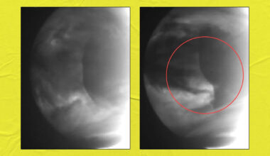 Scientists Detect Weird Anomalies in Clouds of Venus