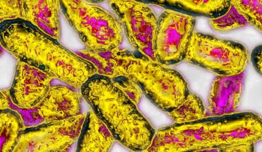Public health officials confirm 18 Legionella infections connected to Kaiser Permanente Santa Clara