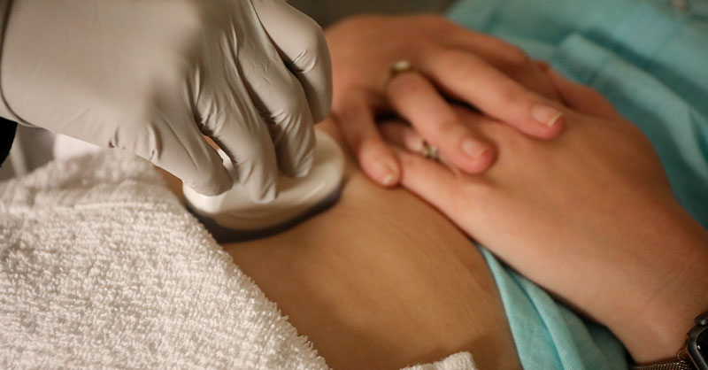Abortion bans lead to worse outcomes for miscarriages