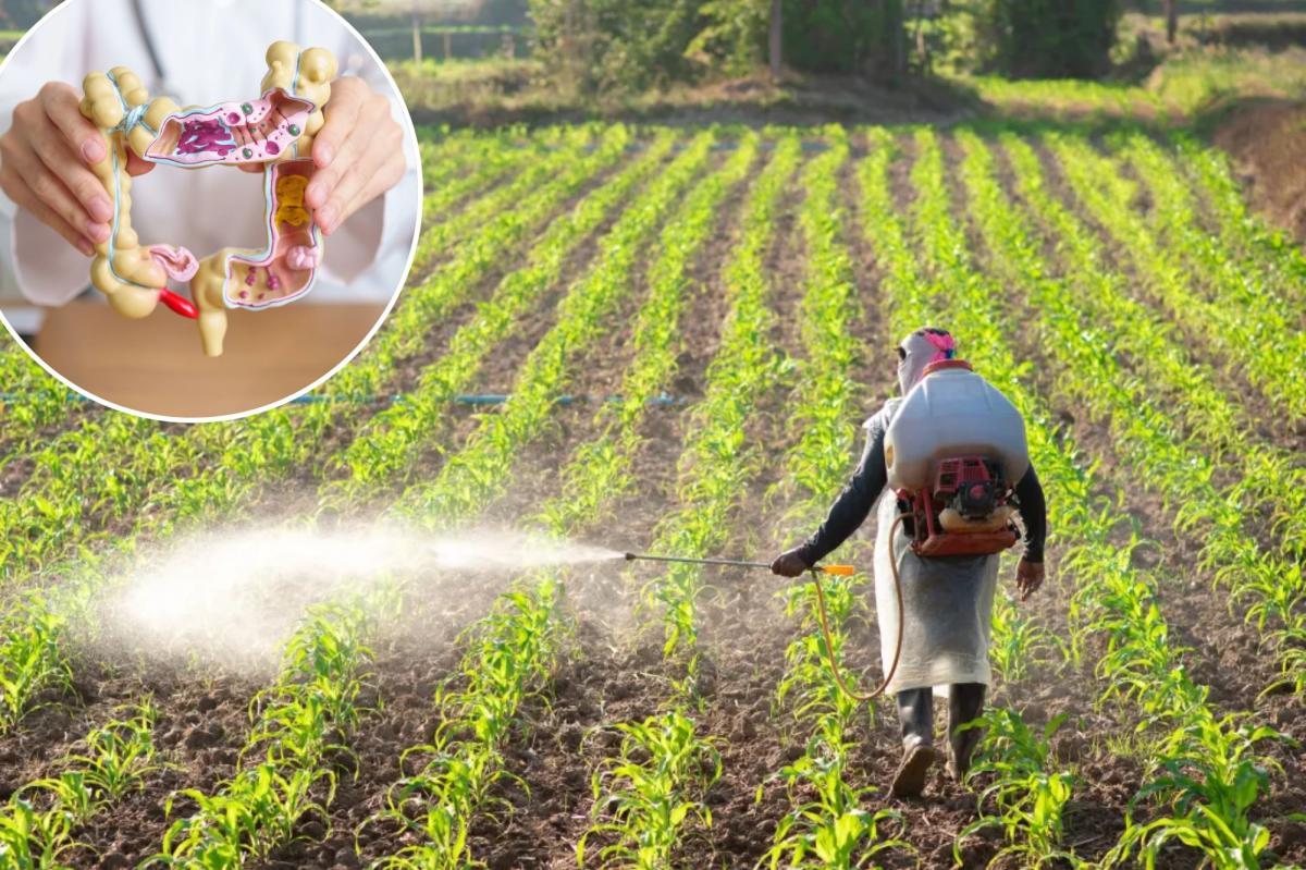 Colorectal cancer in young adults may be linked to weed killer