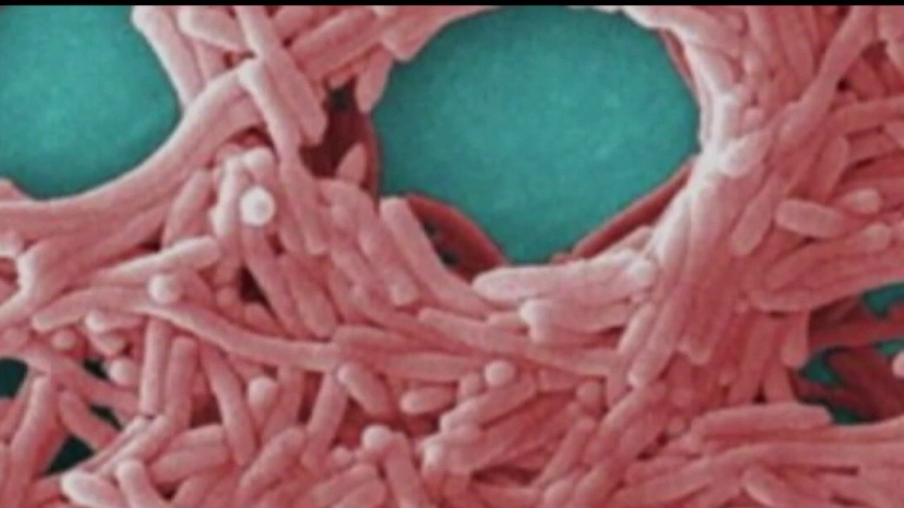 18 cases of Legionella infections confirmed at Kaiser Permanente Santa Clara