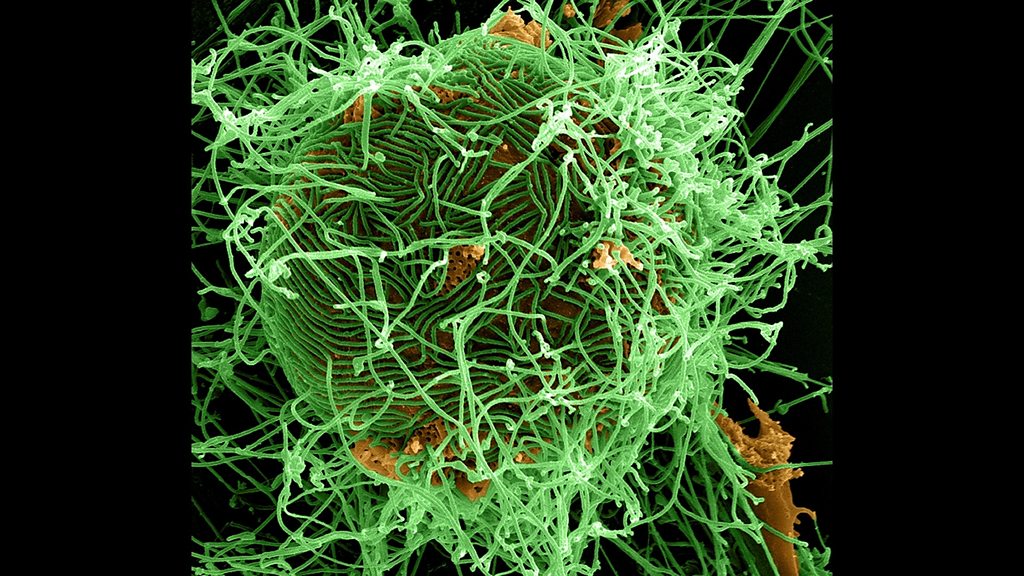 Global News Podcast, What we know about latest Ebola outbreak
