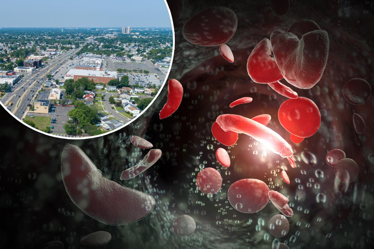 Long Island has 'high burden' for common blood disorder: study