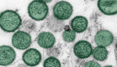 Douglas County adult dies from hantavirus; case not linked to cruise ship