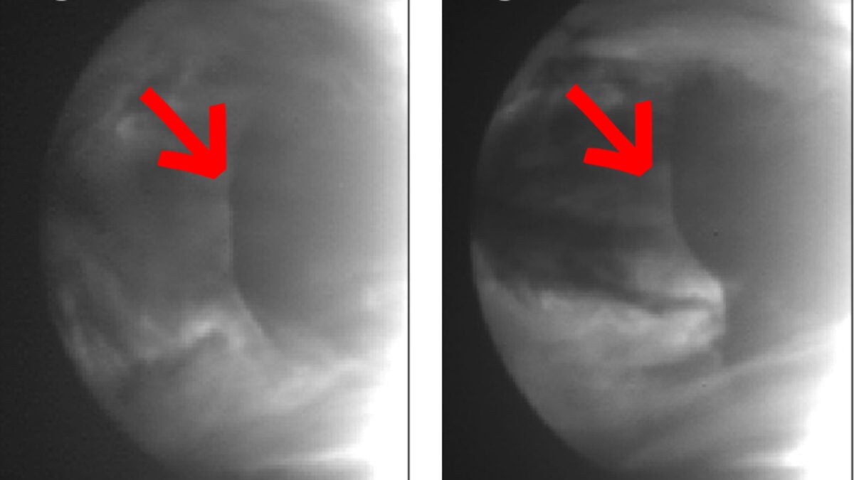 A Gigantic Atmospheric Anomaly Keeps Showing Up on Venus. Astronomers Finally Know Why