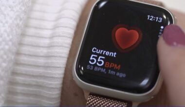 Cardiologist encourages smartwatch users to share data to prevent deadly heart events