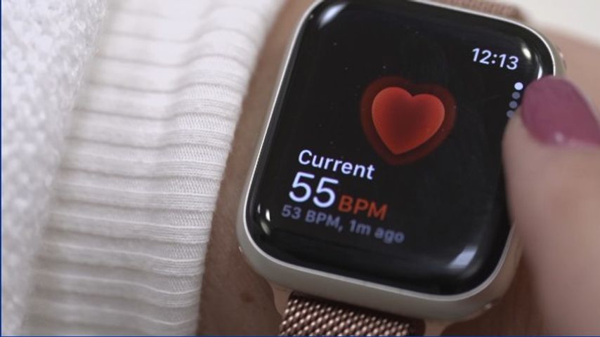 Cardiologist encourages smartwatch users to share data to prevent deadly heart events