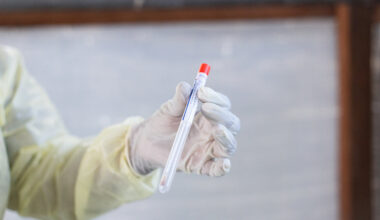 Scientist Charged With Conspiring to Smuggle Mpox Virus Into U.S.