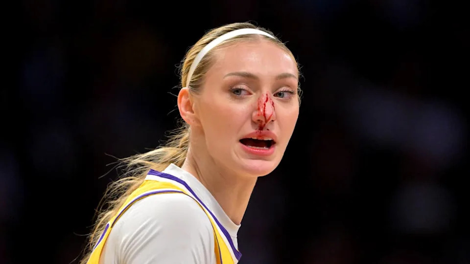 Los Angeles Sparks forward Cameron Brink (22) left the Las Vegas Aces game with a bloody nose.Jayne Kamin-Oncea-Imagn Images