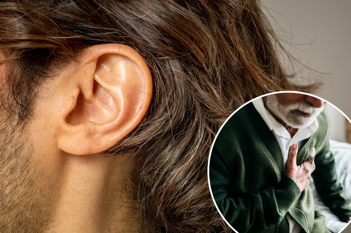 Your earlobes may hold a sneaky clue about future heart disease