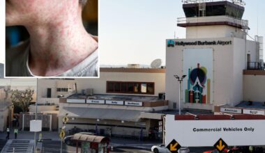 Traveler infected with measles passed through California airport