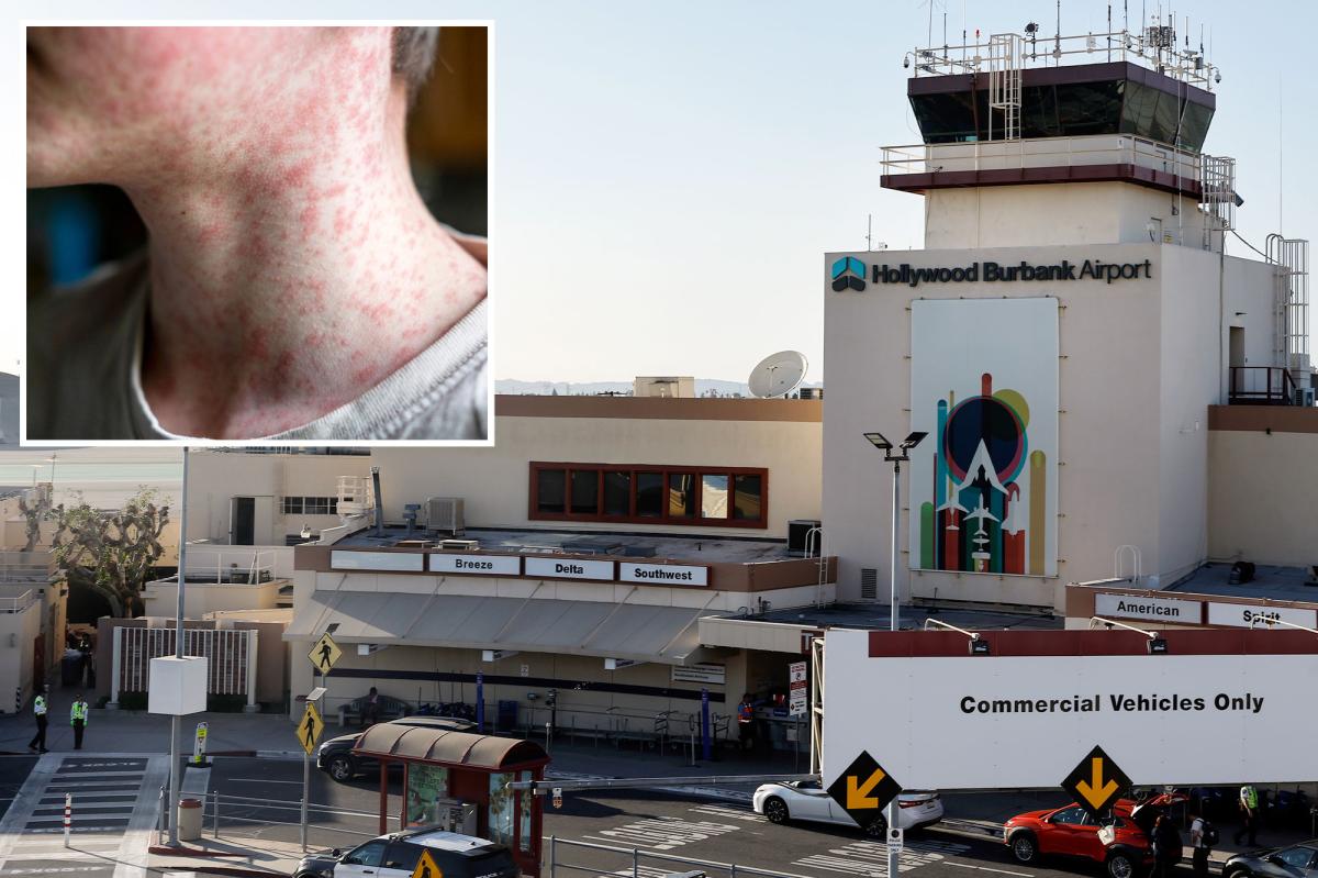 Traveler infected with measles passed through California airport