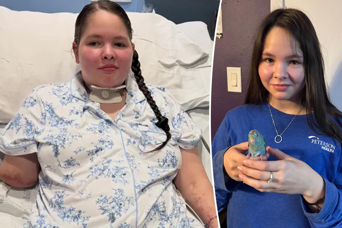 Teen becomes triple amputee following common illness