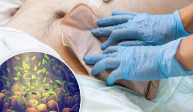 New colorectal cancer discovery could lead to earlier diagnosis