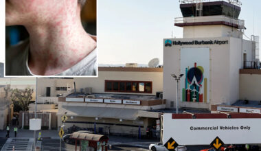 World’s most contagious disease found at busy California airport