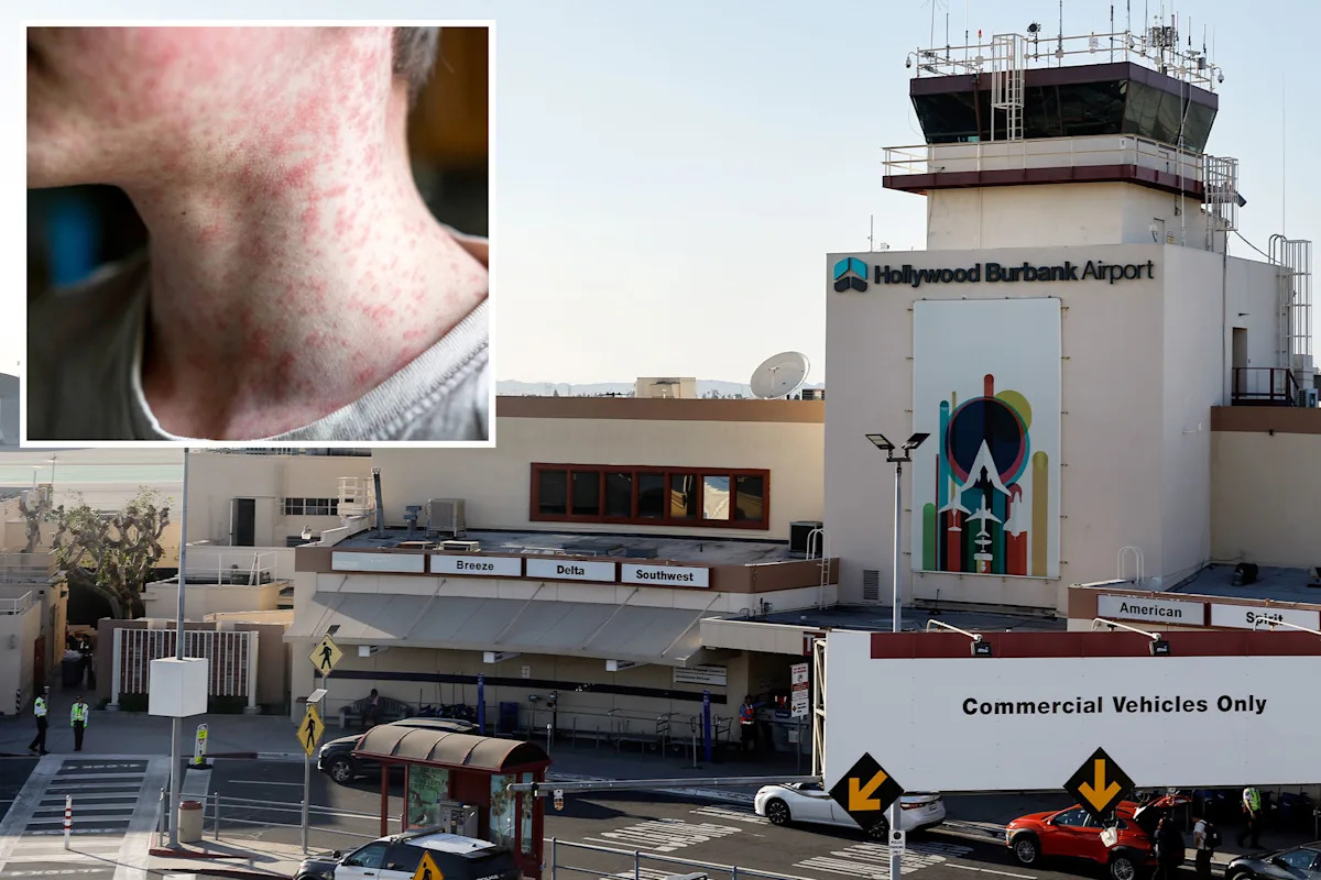 World’s most contagious disease found at busy California airport