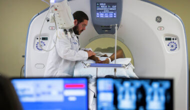 What is ‘scanxiety? What to know about anxiety caused by medical test