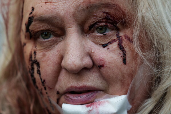 An injured Olena Dniprovska sits in the yard of her house damaged after a Russian strike in Kyiv, Ukraine, on Tuesday, June 2, 2026. (AP Photo/Evgeniy Maloletka)