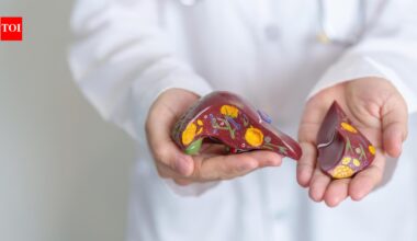 Most people ignore Fatty Liver until it's too late: Liver transplant surgeon explains why weight loss could change everything
