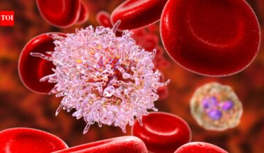 Not every cancer begins with pain: Doctors reveal the everyday symptoms people often ignore for too long