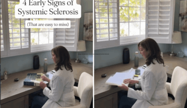 Rheumatologist Shares 4 Signs of Autoimmune Disease That Are ‘Easy To Miss’