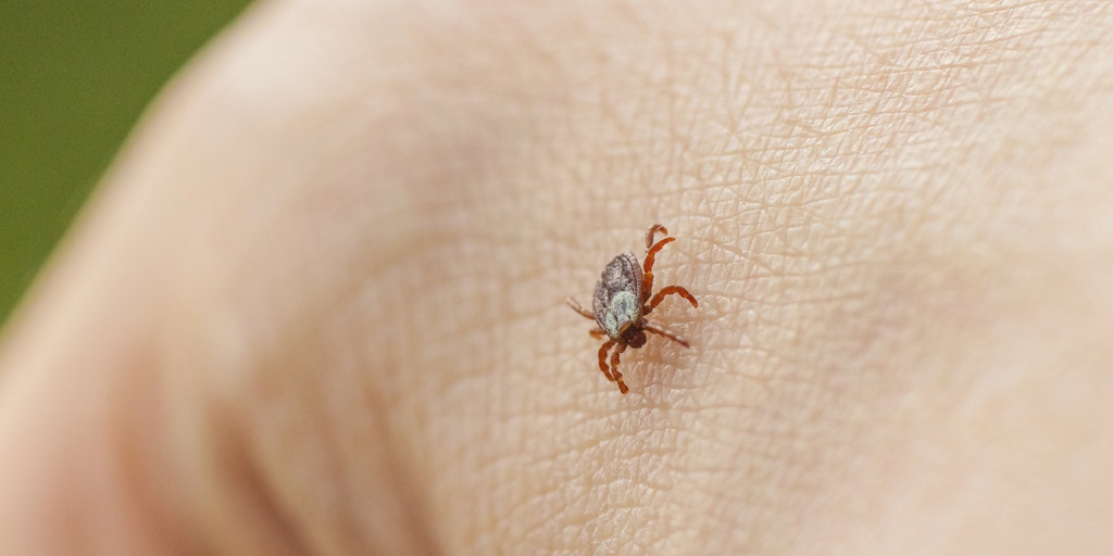 Potentially deadly tick disease ramps up across the US