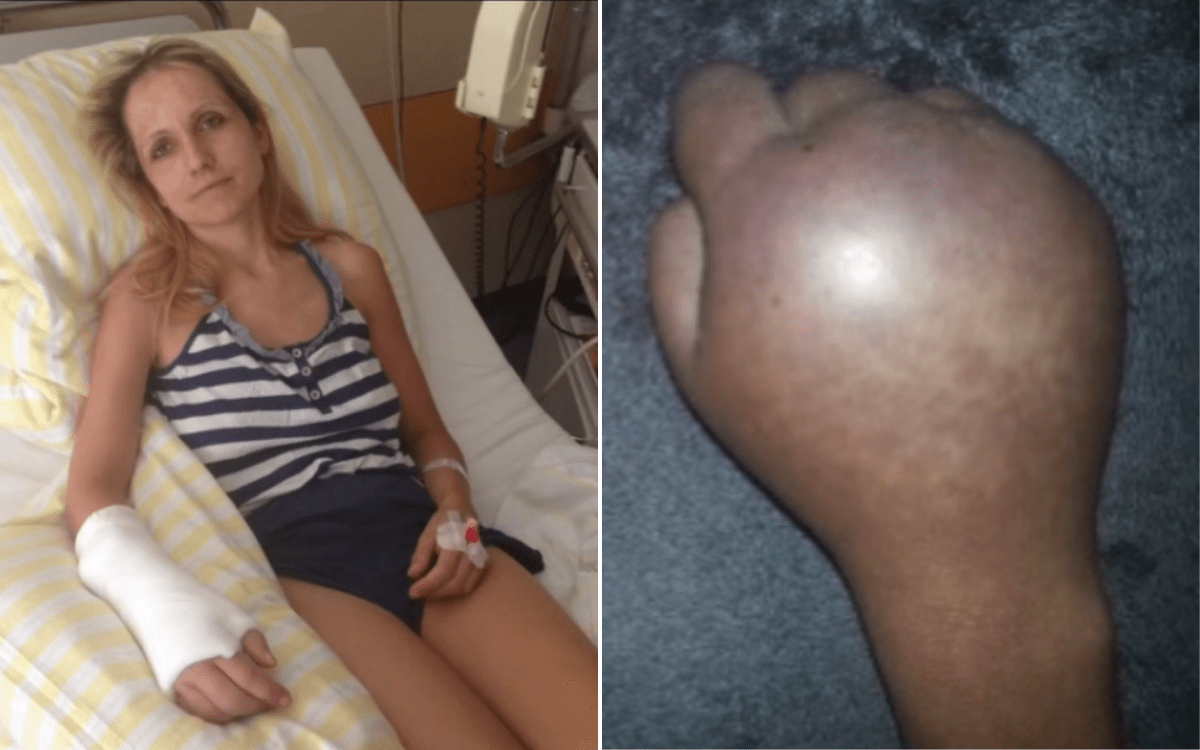 Woman Went for Routine Surgery, Ended up Losing Her Arm–Worse Was to Come