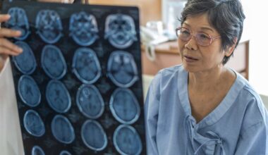 How to recognize signs of a stroke and act as soon as possible