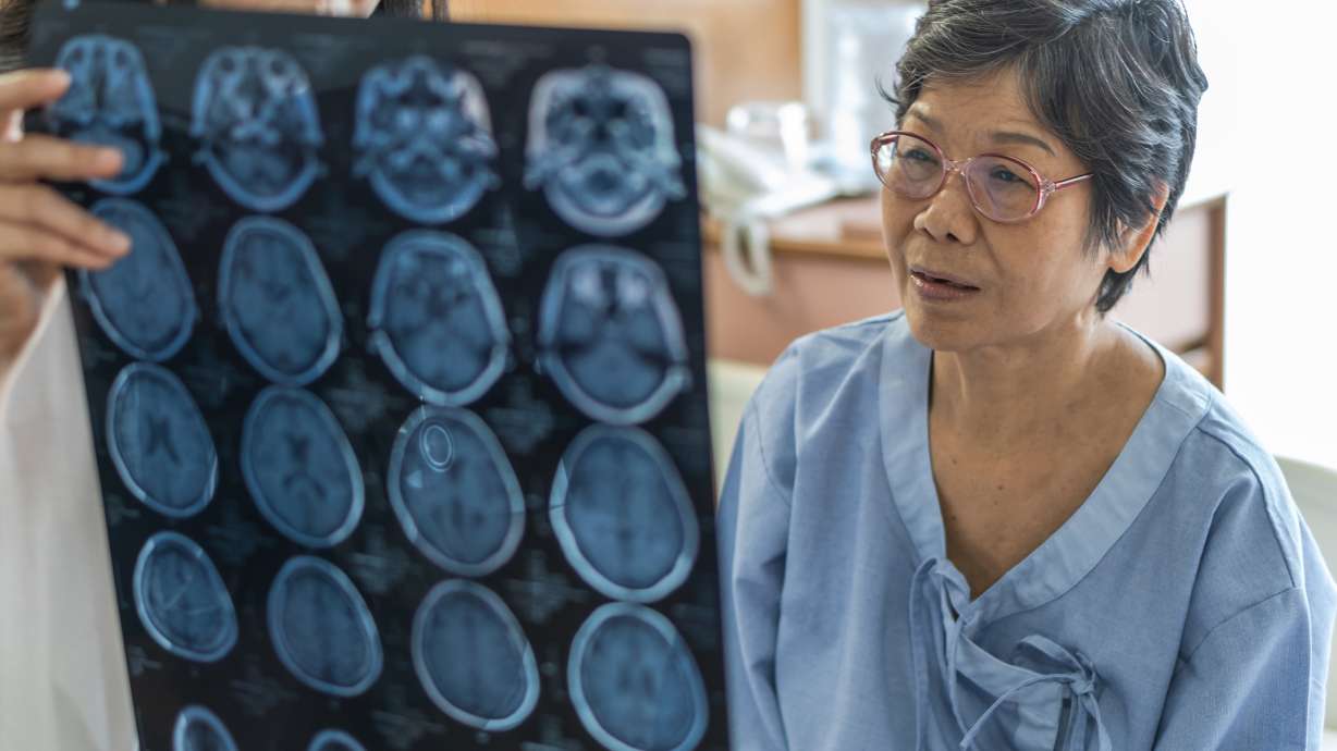 How to recognize signs of a stroke and act as soon as possible