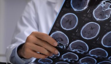 Brain cancer misdiagnosis turns out to be pork tapeworm infection