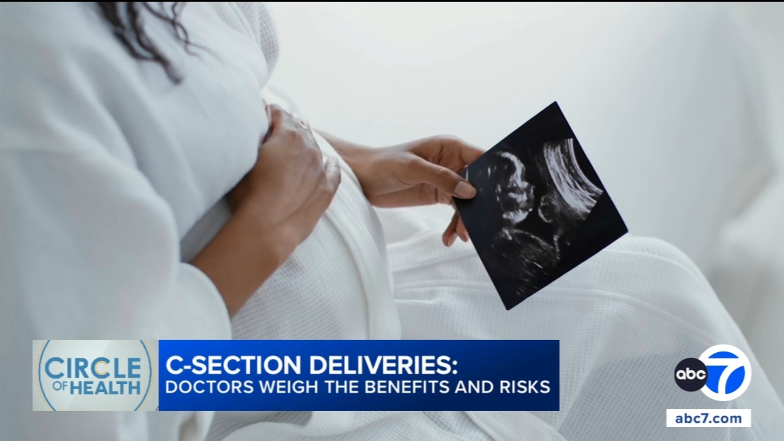 C-section rates in US remain high as experts weigh risks and benefits