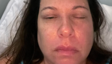 I Suffer From The Most Painful Condition Known To Medicine — And My Life Is A Nightmare