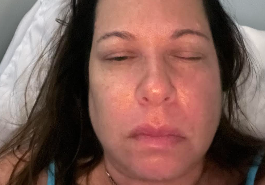 I Suffer From The Most Painful Condition Known To Medicine — And My Life Is A Nightmare